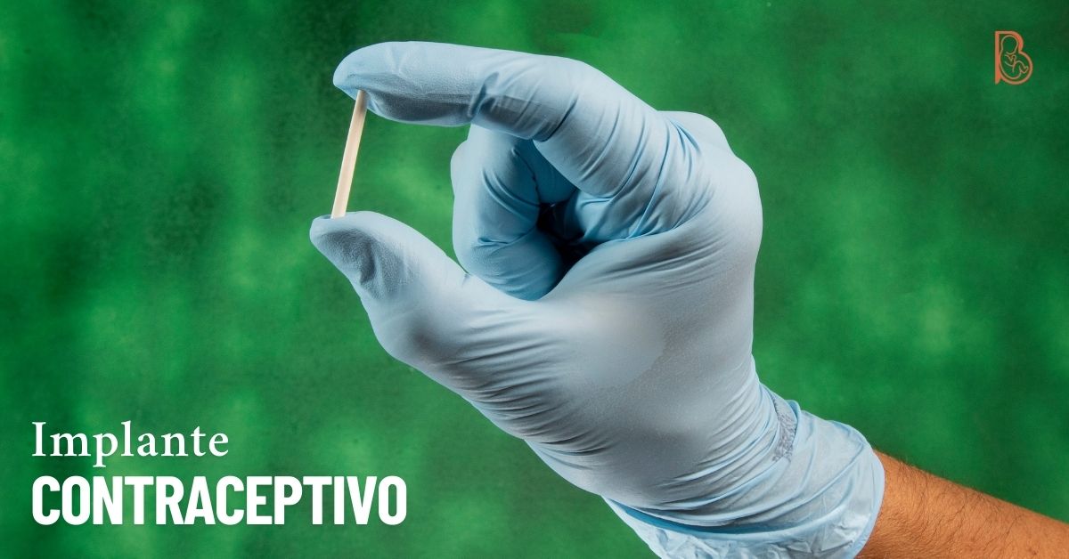 Implante contraceptivo
